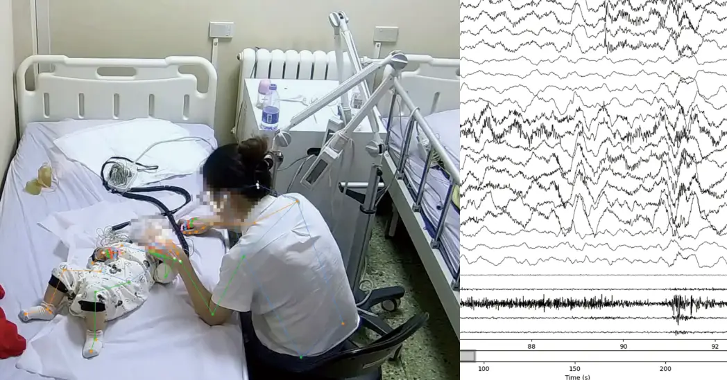视达AI医疗案例
